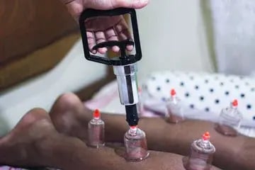 90-Minute Dry Cupping Therapy image